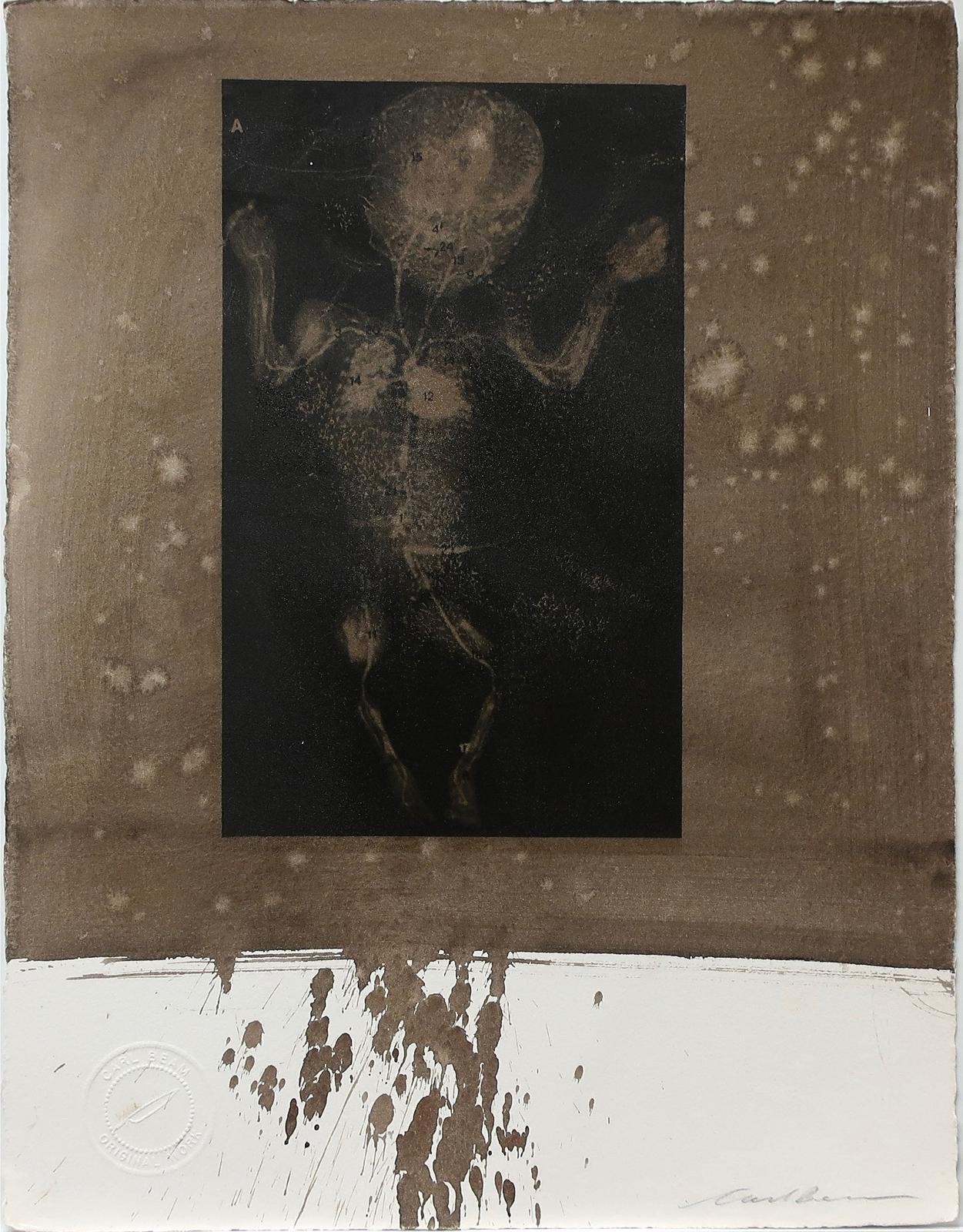 Carl Beam (1943-2005) - Untitled (Infant Xray)