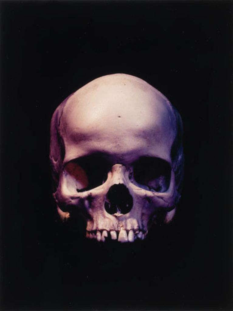 James Michael Lahey (1961) - Rose Skull